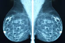 X-ray of breast tissue.